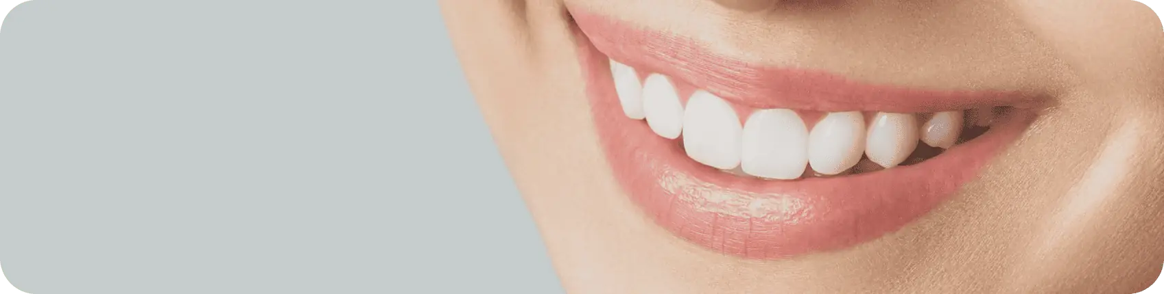 teeth whitening picture of a smile from a woman