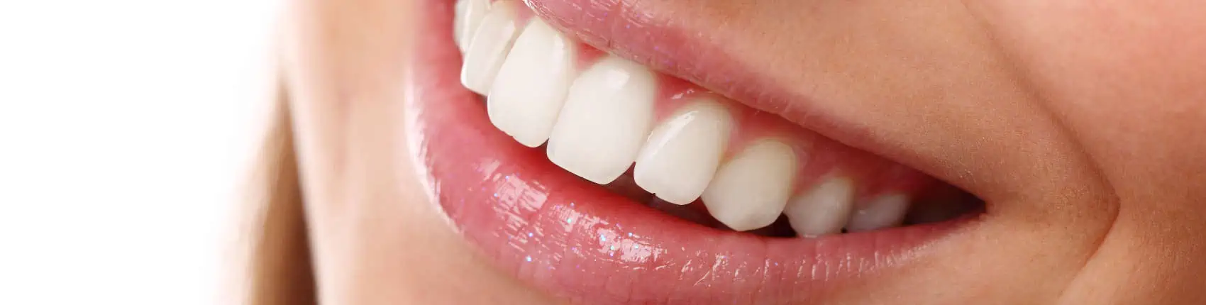 Teeth Whitening example picture - dentist using a UV Light in a teeth whitening procedure